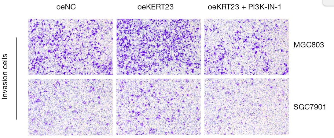 PI3K p85 alpha Antibody - Figure 5 Detection of the effect of oeKRT23 and PI3K-IN-1 intervention on the invasion ability of GC cells by crystal violet staining method (magnification ×100).
