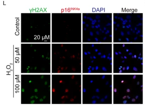 CDKN2A/p16INK4a Antibody - Fig.