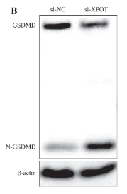GSDMD Antibody - Fig.