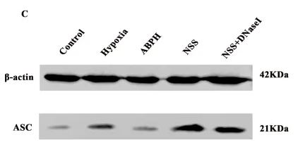 TMS1/ASC Antibody - FIGURE 8 Relative protein expression levels of NLRP3 (A,B), ASC (C,D), caspase-1, and caspase-1-p20 (E,F),.
