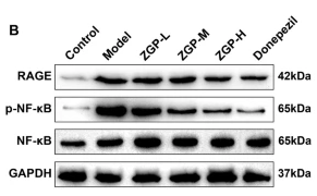AGER/RAGE Antibody - Fig.