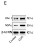 LCN2 Antibody - Fig 2.