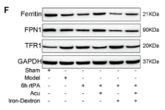 SLC40A1 Antibody - FIGURE 6 Acupuncture regulates iron metabolism disorders following delayed rtPA thrombolysis in rats with cerebral infarction.