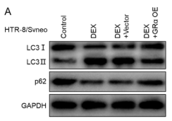 LC3A/B Antibody - FIGURE 4 DEX enhanced autophagy of HTR8/SVeno cells via GRα.