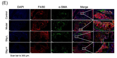 alpha-SMA Antibody - Figure 6 Effects of stigmasterol on aortic macrophage and SMC phenotype in ApoE−/− mice.