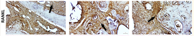 RANKL Antibody - Fig.