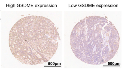 Cleaved-DFNA5/GSDME Antibody - N-terminal - FIGURE 1.