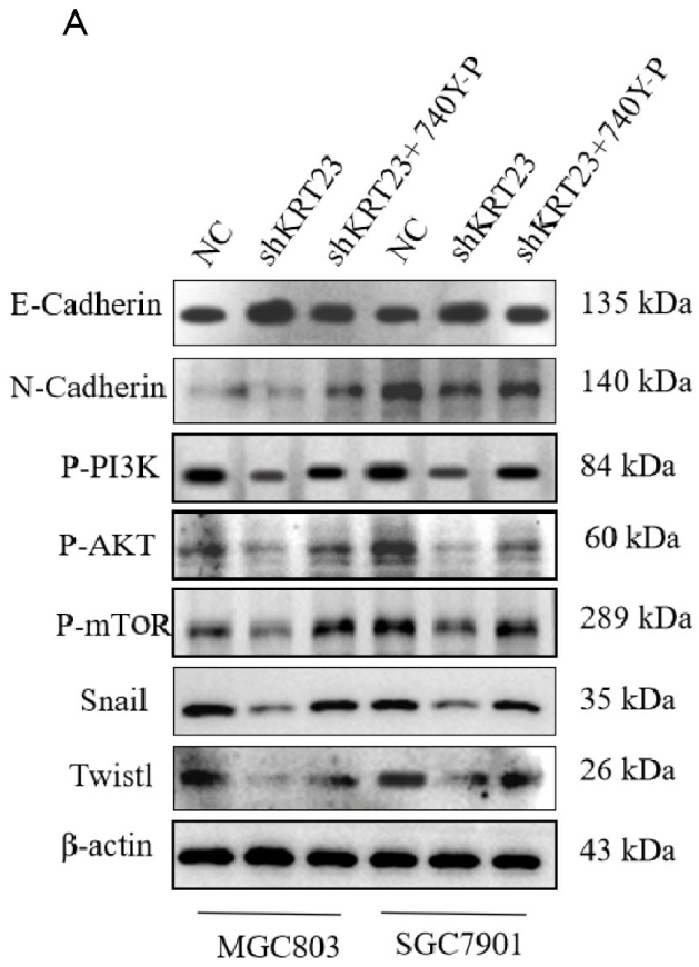 Phospho-AKT1/2/3 (Ser473) Antibody - Figure 7 Western blot detected the effects of oeKRT23 and PI3K-IN-1 intervention on EMT and PI3K/AKT/mTOR signaling pathway.