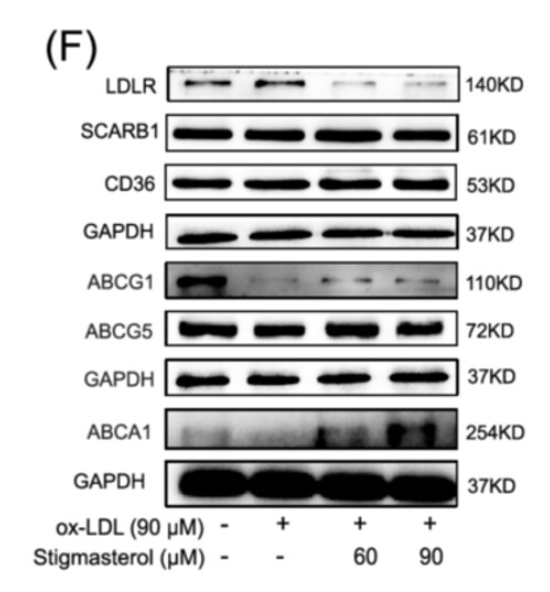 SCARB1 Antibody - Figure 2 Effects of stigmasterol on cholesterol metabolism and phenotypic transition in ox-LDL-treated macrophages.