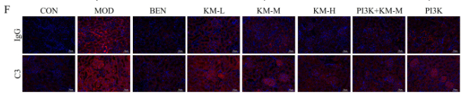 C3 Antibody - Figure 3: Kemeng Fang improves histopathological damage to the kidneys of MN rats.