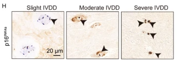 CDKN2A/p16INK4a Antibody - Fig.