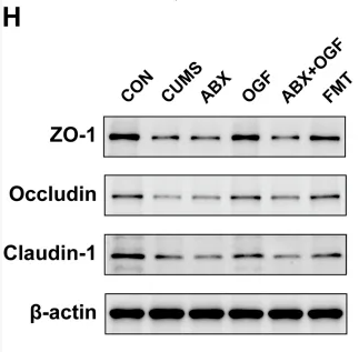 ZO 1 Antibody - FIGURE 4 Effects of FMT on the permeability of the intestinal barrier in CUMS-induced mice.