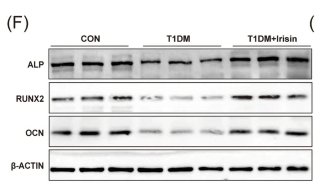 Osteocalcin Antibody - Fig.