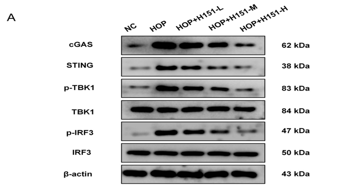 Phospho-TBK1 (Ser172) Antibody - Fig.