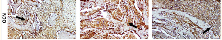 Osteocalcin Antibody - Fig.