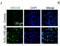 ERCC6L Antibody - Fig.