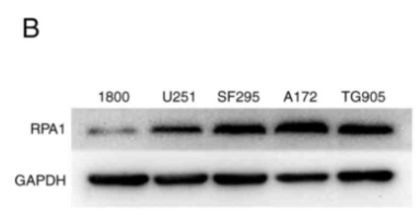 RPA1 Antibody - Figure 2 - RPA1 expression is upregulated in glioma cell lines.
