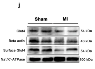 Glut 4 Antibody - Fig.