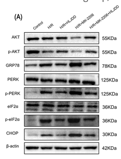 Phospho-eIF2 alpha (Ser51)[Ser52] Antibody - Figure 6 HLJDD Reduces H/R-Induced ER Stress Proteins and mRNA via AKT.