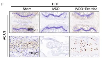 Aggrecan Antibody - Figure 8 Exercise alleviated the progression of IVDD concurrently with NAFLD.