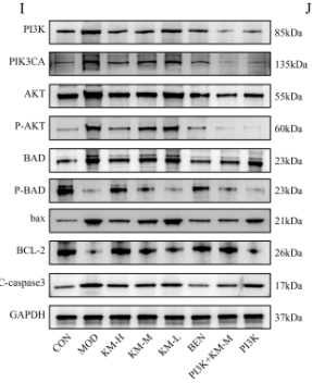 Phospho-AKT1/2/3 (Ser473) Antibody - Figure 4: Kemeng Fang alleviates podocyte damage by activating the PI3K/AKT signaling pathway.