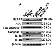 NLRP3 Antibody - Figure 9 Western blot analysis of NLRP3, pro-caspase-1, ASC, caspase-1, IL-1, and IL-18 protein expression levels.