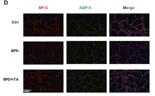 AQP5 Antibody - Fig.