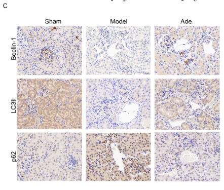 LC3B Antibody - FIGURE 5 Adenosine promotes autophagy in kidney fibrosis.