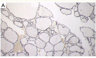 Osteopontin Antibody - Figure 5.