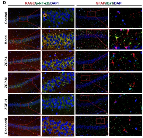 GFAP Antibody - Fig.
