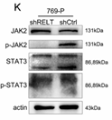 Phospho-JAK2 (Tyr931) Antibody - FIGURE 3Analysis of RELT hub genes.