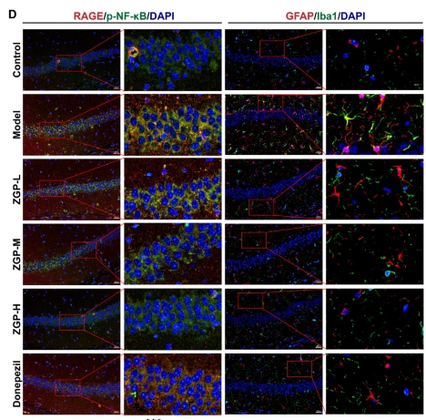 AIF1/IBA1 Antibody - Fig.