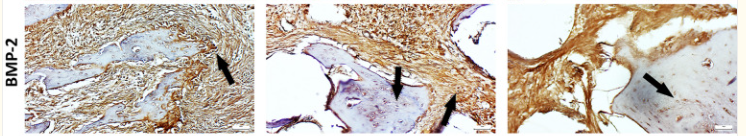 BMP2 Antibody - Fig.