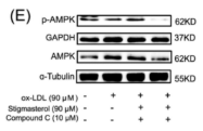 Phospho-AMPK alpha (Thr172) Antibody - Figure 3 Stigmasterol inhibits macrophage phenotypic transition to pro-inflammatory type by influencing the AMPK/NF-κB/NLRP3 pathway.