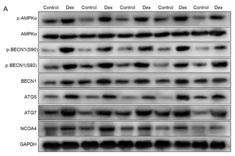 APG5L/ATG5 Antibody - FIGURE 5 DEX activated the AMPKα/BECN1 and ATG5/ATG7/NCOA4 signalling pathways via GRα.
