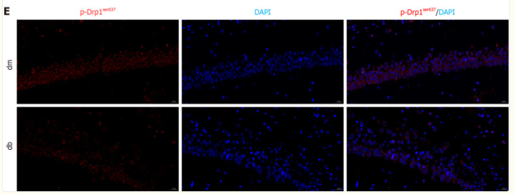 Phospho-DRP1 (Ser637) Antibody - Figure 5.
