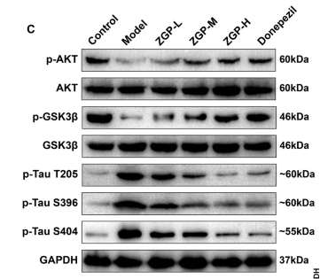 Phospho-GSK3 beta (Ser9) Antibody - Fig.