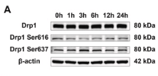 Phospho-DRP1 (Ser637) Antibody - Fig.