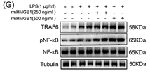 TRAF6 Antibody - Figure 4 HMGB1 promotes M1 polarization of macrophages through TRAF6/NF-κB pathway.
