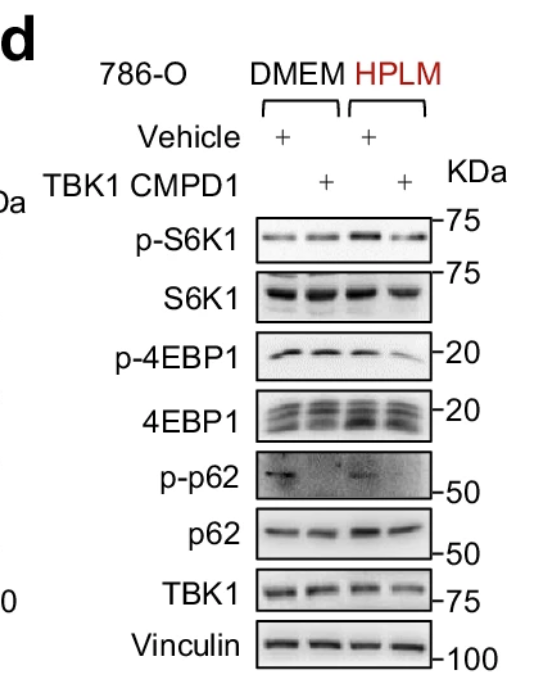 Phospho-SQSTM1/p62 (Ser366) Antibody - Fig.
