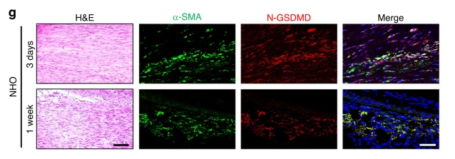 GSDMD N-Terminal Antibody(Mouse specific) - Fig.