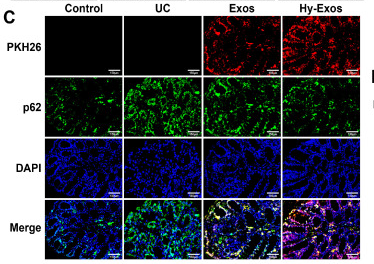 SQSTM1/p62 Antibody - Figure 8.