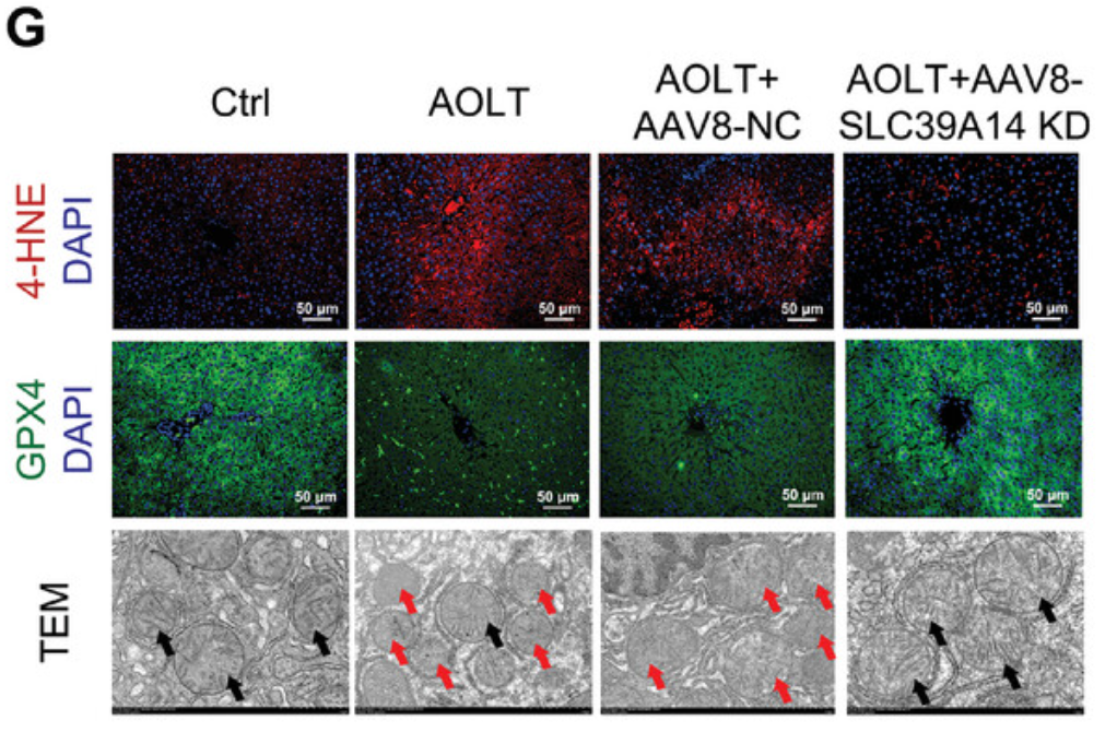 GPX4 Antibody - Figure 2 Knockdown of SLC39A14 reduces hepatocyte ferroptosis and alleviates hepatic ischemia and reperfusion injury.