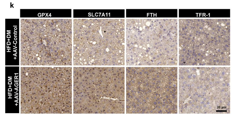 FTH1 Antibody - Fig.