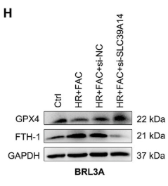 GPX4 Antibody - Figure 2 Knockdown of SLC39A14 reduces hepatocyte ferroptosis and alleviates hepatic ischemia and reperfusion injury.