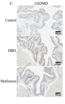 GSDMD Antibody - Fig.