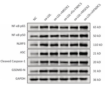 GAPDH Antibody - Figure 10｜Effect of overexpressing/silencing FNDC5 gene on mRNA expression levels of NF-κB p65, NF-κB p50, NLRP3, ASC, Caspase-1 and GSDMD.