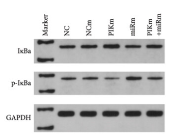 IKB alpha Antibody - Figure 7 (c) PIK3R1 inhibits IκBa phosphorylation and reduces IκBa degradation and MMP12/MMP14 in MMQ and GH3 cells.