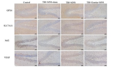 xCT Antibody - Fig.