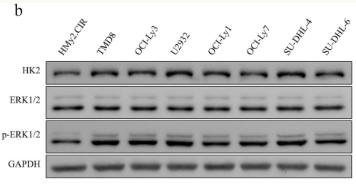 GAPDH Antibody - Figure 1 HK2 was overexpressed in DLBCL cell lines.